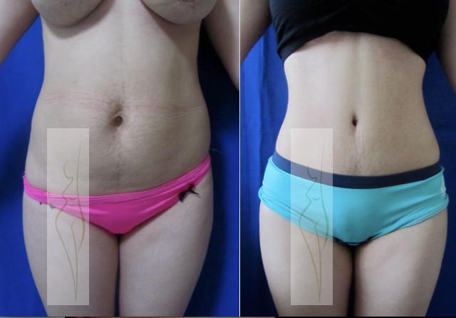 Nieto-Tejeda Plastic Surgery