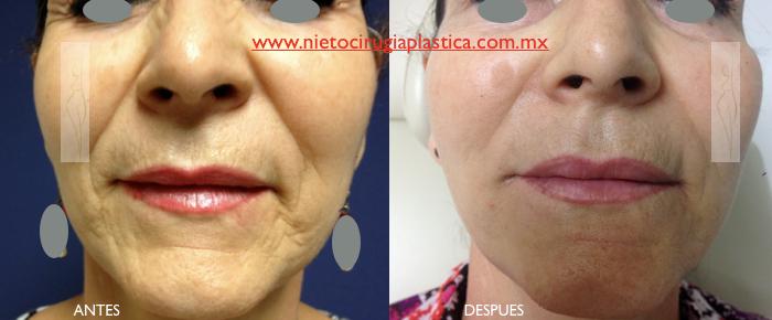 Nieto-Tejeda Plastic Surgery
